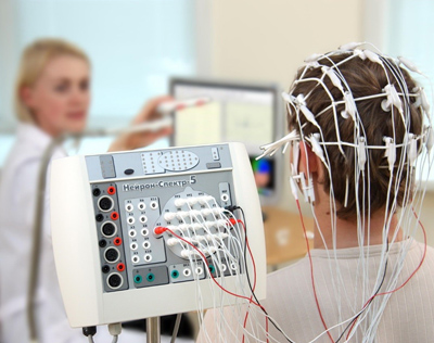 Eletroencefalograma Digital - EEG