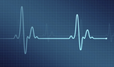 Eletrocardiograma Digital - ECG